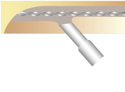 3. Insert length of 6mm SAMSON HELICAL BAR and push into grout. Apply a further bead of SAMSON BRICK GROUT allowing enough room in slot to re-point with a matching mortar. Then conceal the slot with SAMSON COLOUR-MATCH MORTAR.