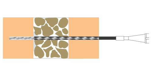 3. Pump the cementitious grout into back of the hole.